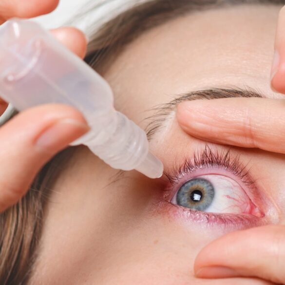 Eye Treatments in Buffalo NY