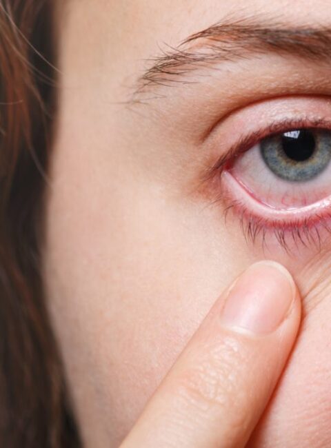 Dry Eye Symptoms and evaluations in Orchard Park NY