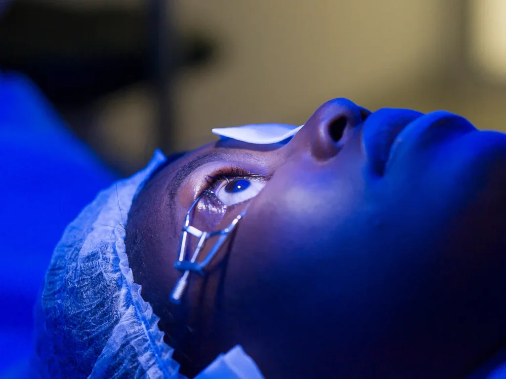Glaucoma Surgery