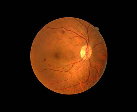 Eye scan in Orchard Park NY